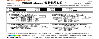 VSRAD解析結果レポート